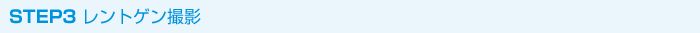 STEP3 レントゲン撮影